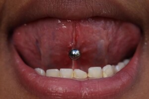Tongue Piercing Aftercare, Safety, and Healing by H2Ocean Healing Rinse.